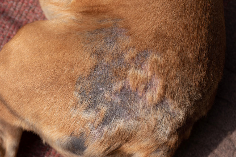 Scalp showing localized hair loss with smooth skin typical of alopecia.