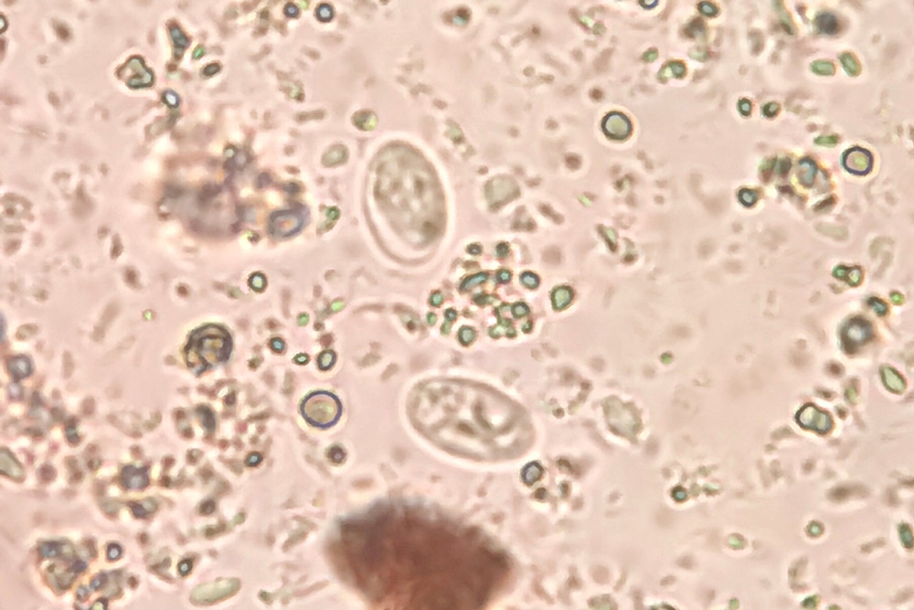 Giardia lamblia cyst viewed under a microscope.